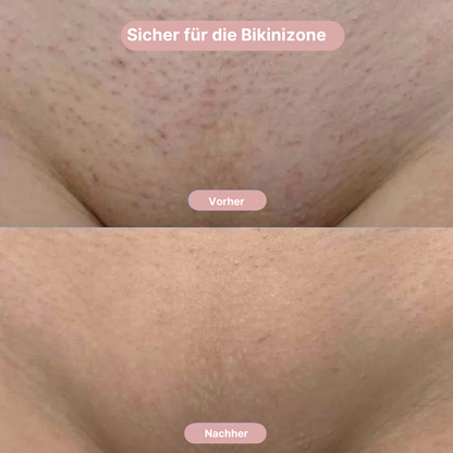 GlowAura™ Prestige – Der luxuriöse 2-in-1 Trimmer für seidig glatte Haut