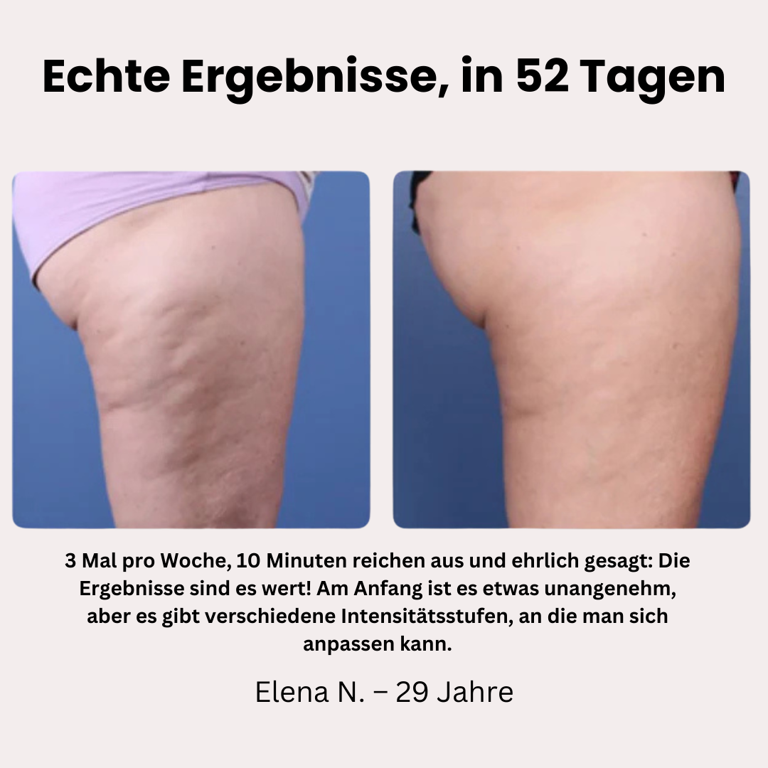 MiraBelle™ – Dein neues Hautritual