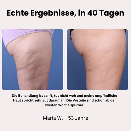 MiraBelle™ – Dein neues Hautritual